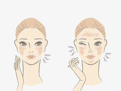 秋季皮膚為何會(huì)過(guò)敏？芳香世家告訴你